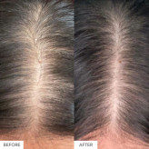 مکمل مو هیرتامین Hairtamin | مکمل تقویت رشد مو، ضدریزش و افزایش ضخامت مو