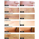 روغن ترمیمکننده بایو اویل Specialist Skincare | رفع ترکهای بارداری و بهبود اسکار